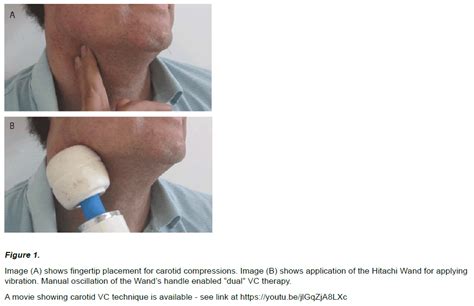 manual carotid compression test|manual.